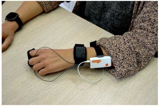 Example of a Shimmer sensor worn on a wrist with finger electrodes